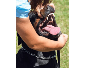 An owner checking their Rottweiler's mouth for problems that may cause drooling